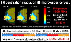 anses-micro-ondes